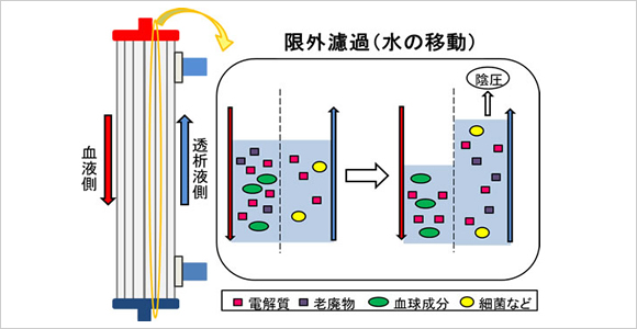 と は 透析 血液